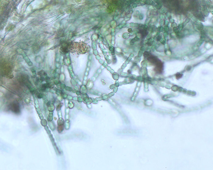 Cyanobakterien Zellfäden aus einem Algenfarn. Deutlich zu sehen sind die größeren runden Heterocysten