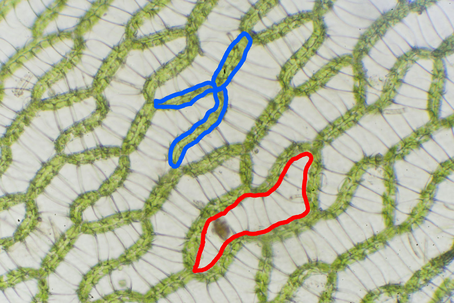 Chlorocyten und Hyalocyten von Torfmoos