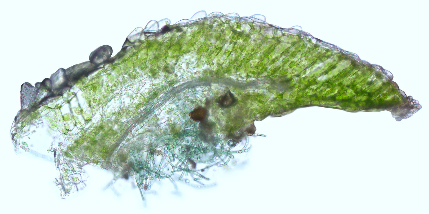 Tangentialschnitt eines Algenfarns mit Cyanobakterien sichtbar