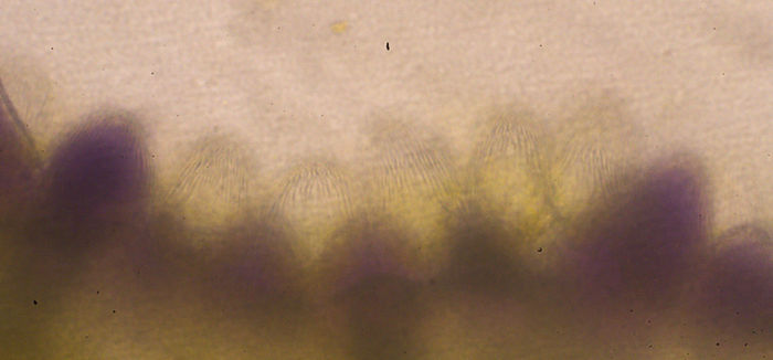 Cuticularleisten
